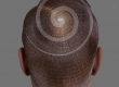 The Latest Technique Targeting Naturalness “Archimedes Hair Transplantation”